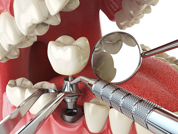 Best After-Hours Dental Trauma Care in Moraine, OH